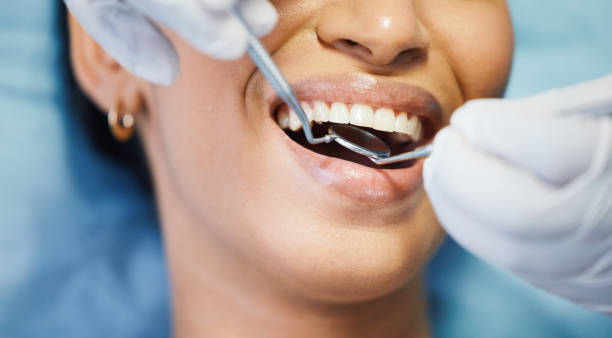 Best Emergency Tooth Extraction in Edison, GA